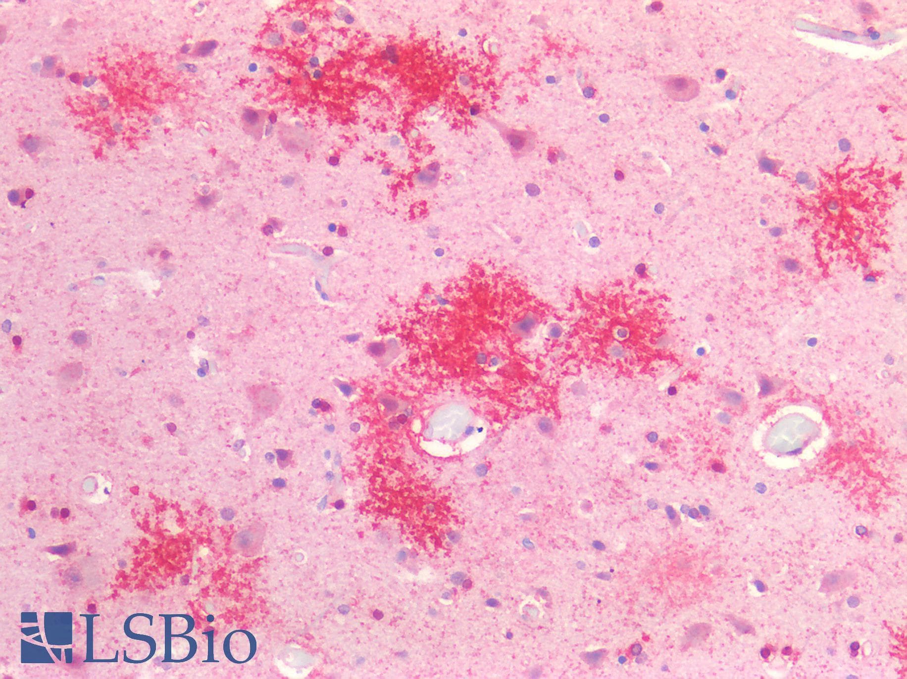 IHC-plus™ Proenkephalin / PENK Antibody