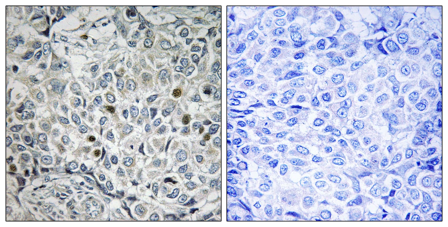 Polyclonal Rabbit anti-Human USP53 Antibody (aa951-1000, IHC)