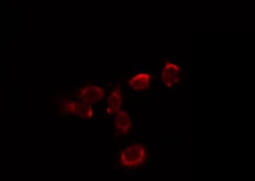 HBA2 / Hemoglobin Alpha 2 Antibody