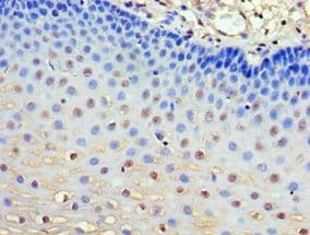 Polyclonal Rabbit anti-Human GRB7 Antibody (aa233-532, IHC, WB)