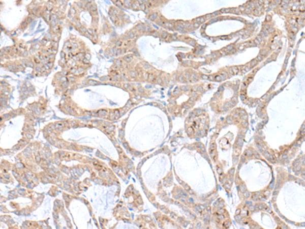 PLGLB2 / PLGLB1 Antibody