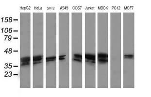 MAP2K3 / MEK3 / MKK3 Antibody (clone OTI4B3)
