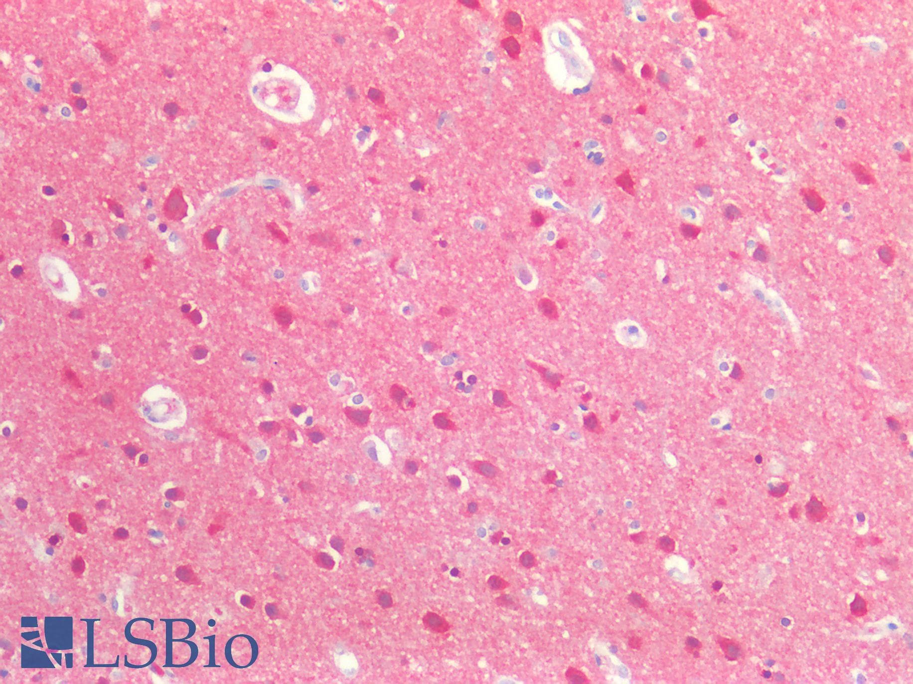 IHC-plus™ MAPT / Tau Antibody (Internal)