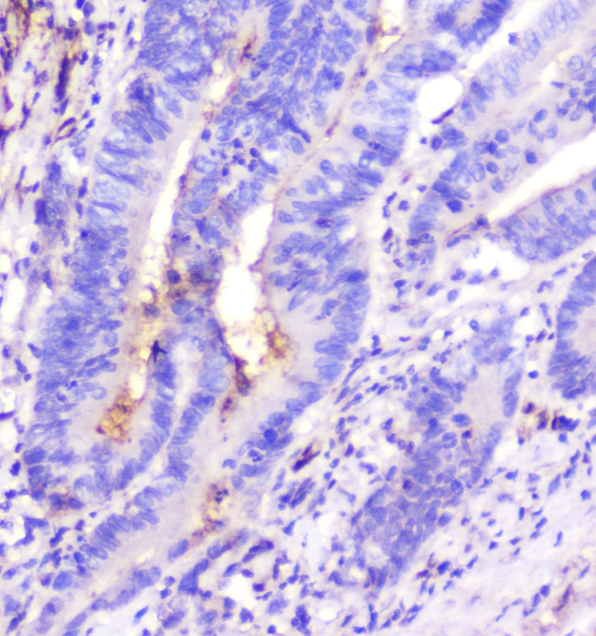 ADA / Adenosine Deaminase Antibody