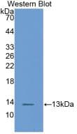 FABP1 / L-FABP Antibody (aa2-127, APC)