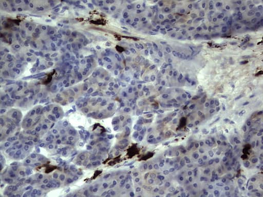 S100A9 / MRP14 Antibody (clone OTI8C2)