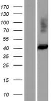 FIBP Protein (Over-Expression Lysate Myc-DDK (Flag))