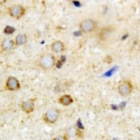 ATAD3A Antibody