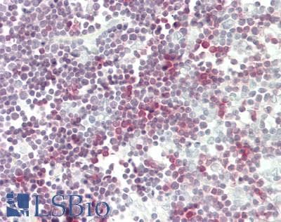 IHC-plus™ CD3 Antibody (clone RBT-CD3)