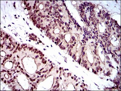 NELFA / WHSC2 Antibody (Amino Acid: 280-511, clone 6B11H8)