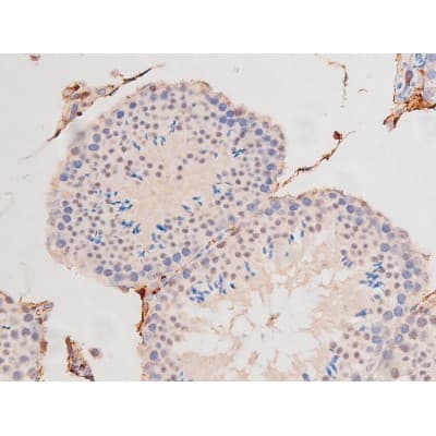 c-Kit / CD117 Antibody (phospho-Tyr703)