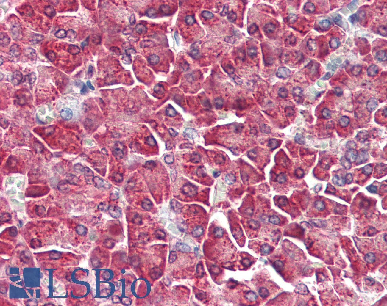 IHC-plus™ Polyclonal Rabbit anti-Human MAP3K5 / ASK1 Antibody (IHC, IF, WB)