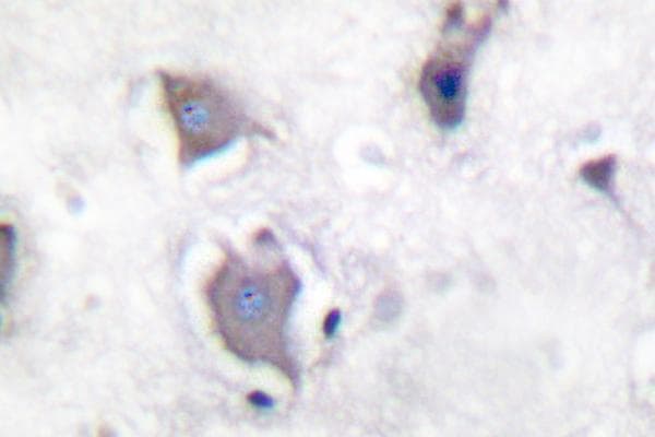NTRK2 / TRKB Antibody (phospho-Tyr706)