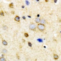 ACVR2 / ACVR2A Antibody