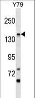 PIGO Antibody (aa955-983)