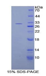 Rat DGKG Protein (Recombinant His-T7)