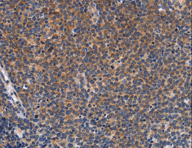 Polyclonal Rabbit anti-Human CCL23 / MIP3 Antibody (IHC)