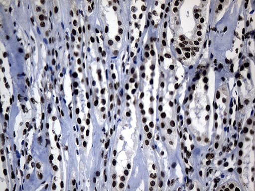 POLR2A / RNA polymerase II Antibody (aa1351-1614, clone OTI2B7)