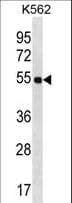 LAX1 / LAX Antibody (aa369-398)