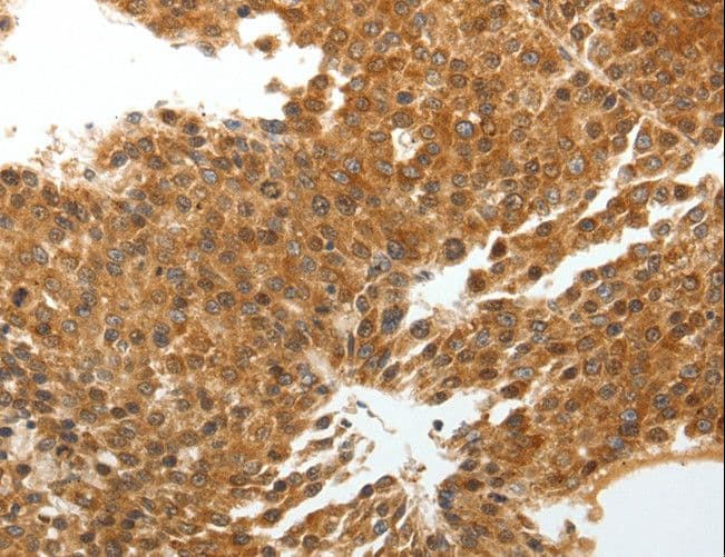 TNXB / Tenascin XB Antibody