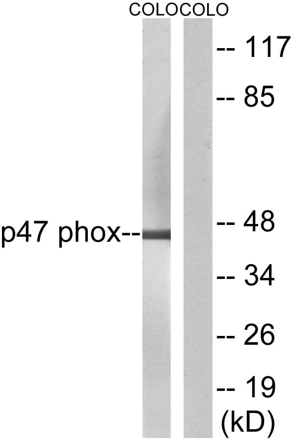 Polyclonal Rabbit anti-Human NCF1 / p47phox / p47 phox Antibody (aa281-330, IF, WB)