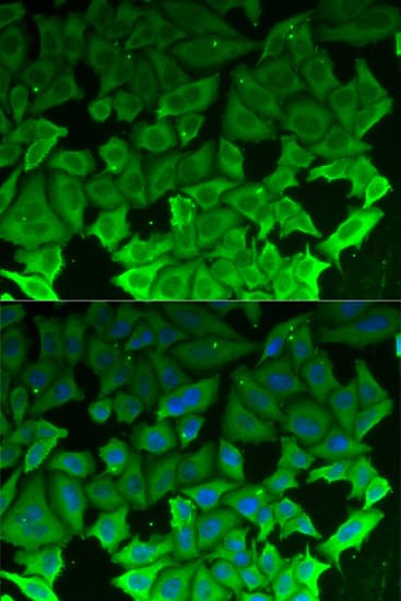 Polyclonal Rabbit anti-Human EEF2K Antibody (IHC, IF, WB)