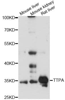 TTPA Antibody