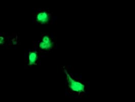 TP73-AS1 / KIAA0495 Antibody (clone OTI2A9, Carrier-free)