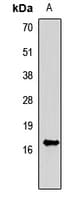 Polyclonal Rabbit anti-Human FGF1 / Acidic FGF Antibody (IHC, WB)