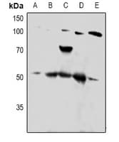 Polyclonal Rabbit anti-Human PTP1B Antibody (IHC, WB)