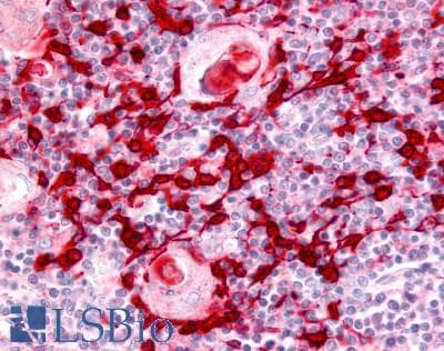 IHC-plus™ Polyclonal Rabbit anti-Human USP4 Antibody (Internal, IHC)