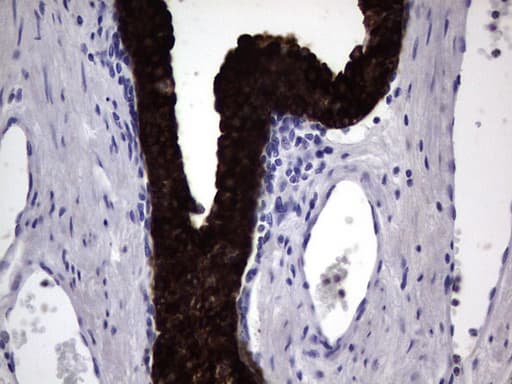 KRT19 / CK19 / Cytokeratin 19 Antibody (aa240-390, clone OTI7H7)