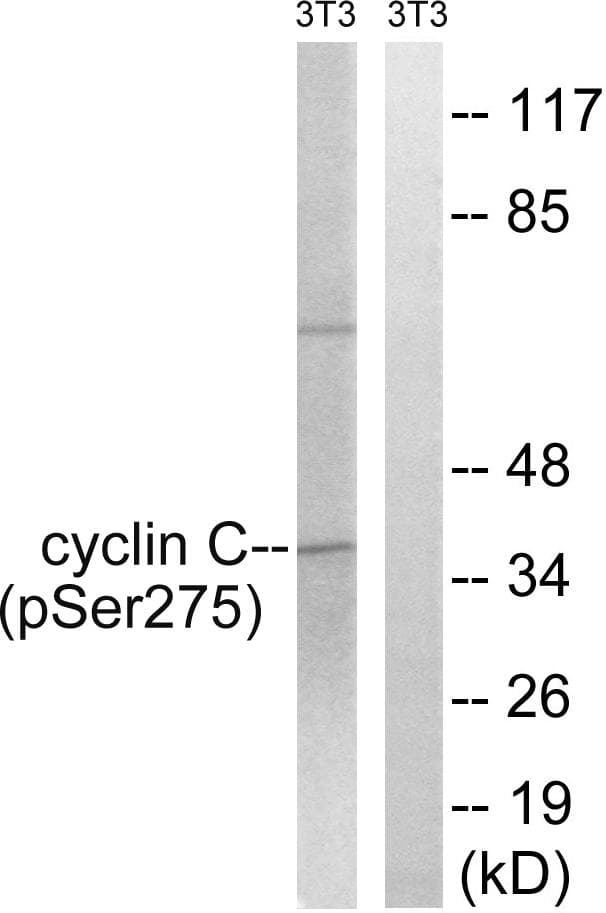 Polyclonal Rabbit anti-Human CCNC / Cyclin C Antibody (phospho-Ser275, IHC, WB)