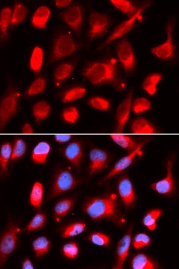 Polyclonal Rabbit anti-Human UROD Antibody (IHC, IF, WB)