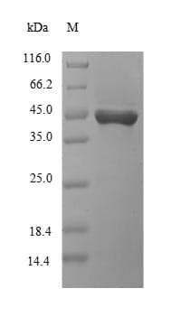 Human KIR2DS3 Protein (Recombinant 10His-SUMO, N-terminus + Myc, C-terminus)