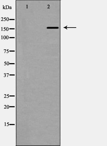 CUX1 / CASP Antibody
