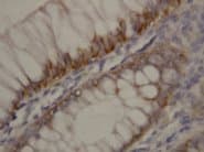 ROCK2 Antibody (N-Terminus)