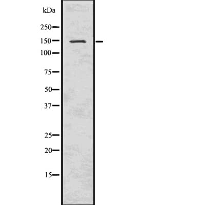 SMC3 / HCAP Antibody