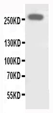 Polyclonal Rabbit anti-Human ABCA4 Antibody (aa1893-1906, WB)