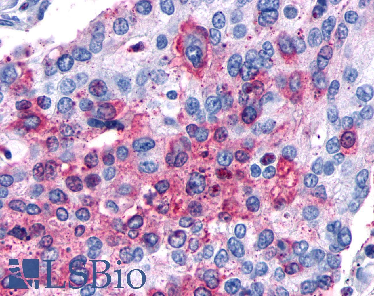 IHC-plus™ MC1R Antibody (Cytoplasmic Domain)