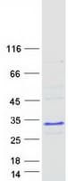 Human RNF114 / ZNF313 Protein (Recombinant Myc-DDK (Flag))