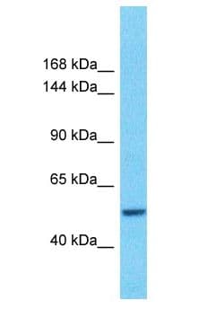 Polyclonal Rabbit anti-Human CHD2 Antibody (aa1-50, WB)