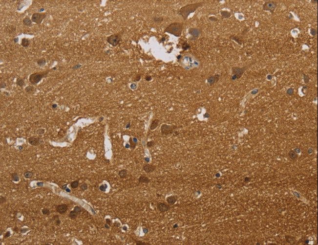 ELAVL2 / HUB Antibody