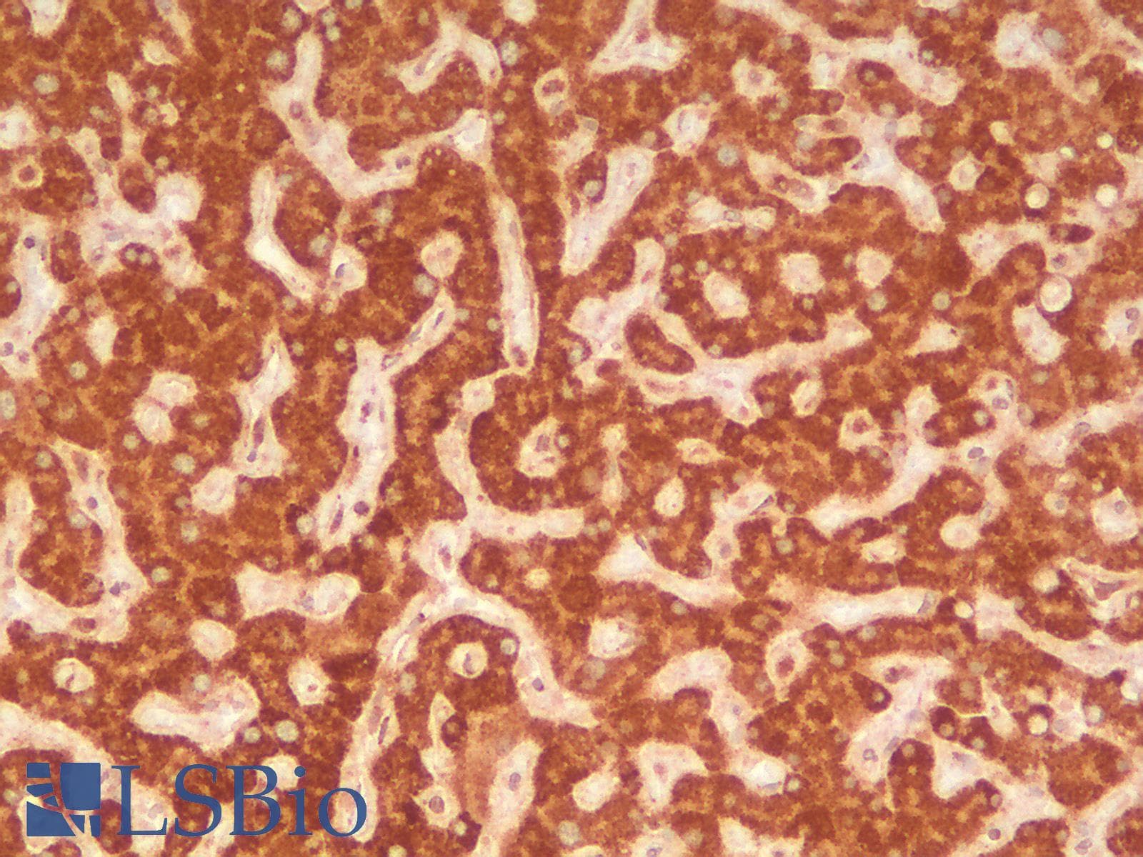 IHC-plus™ HSPD1 / HSP60 Antibody (clone rGROEL/780)