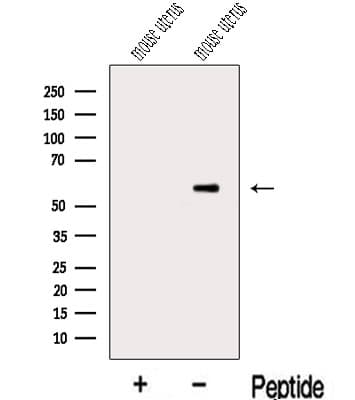 MIER3 Antibody