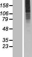 SLC35A3 Protein (Over-Expression Lysate Myc-DDK (Flag))