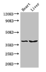 CTSB / Cathepsin B Antibody