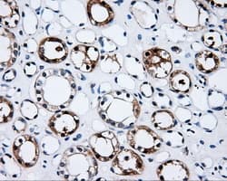 Monoclonal Mouse anti-Human PSMC3 Antibody (clone OTI7B10, IHC, IF, WB)
