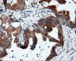 Monoclonal Mouse anti-Human BAP / SIL1 Antibody (clone OTI3B11, IHC, IF, WB)