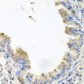 PIK3CB / PI3K Beta Antibody